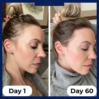 Zempify Hair Growth Serum Roll