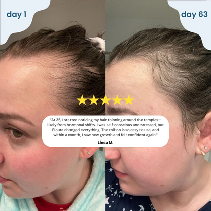 Zempify Hair Growth Serum Roll